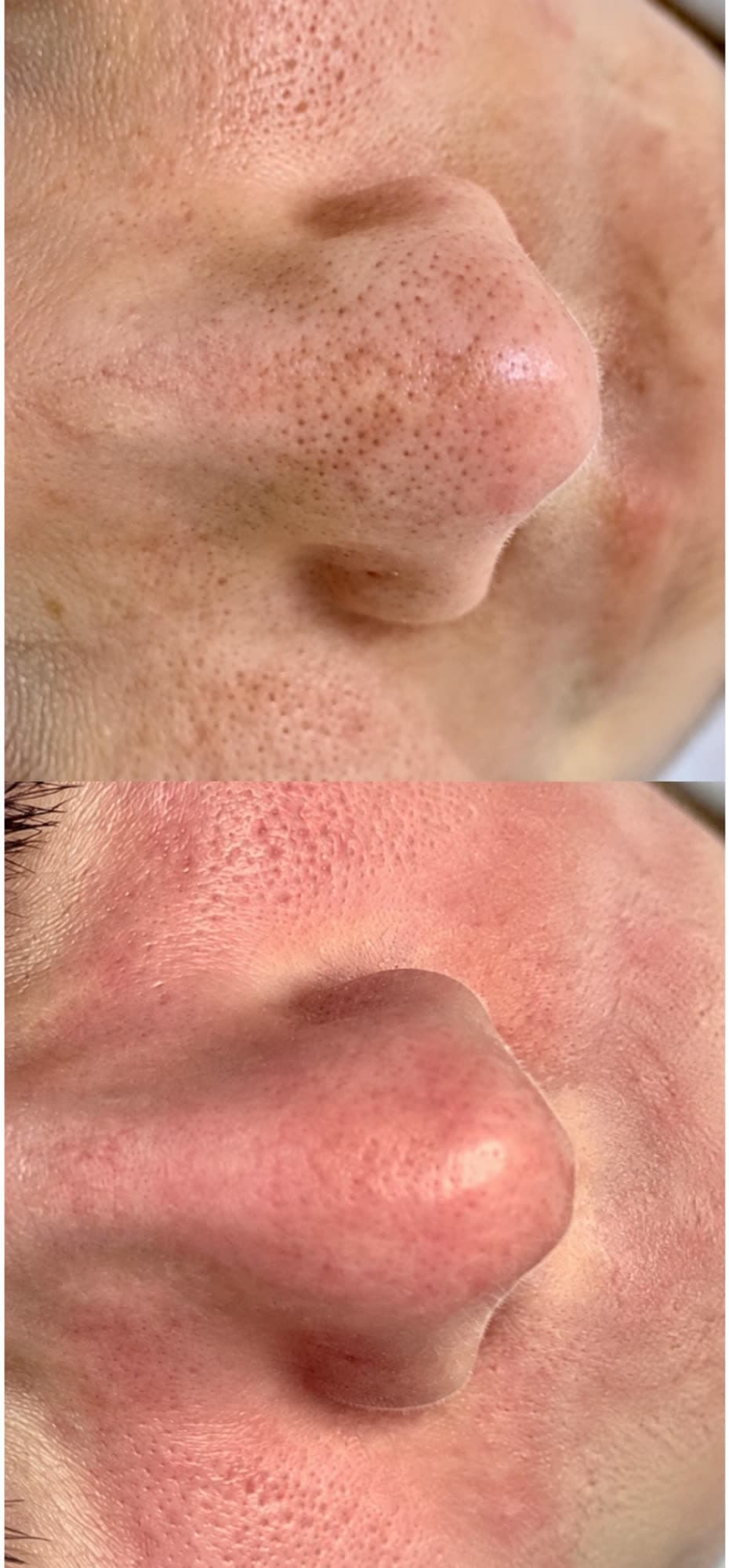 Before and after Ora Signature Facial at Ora Medical Spa